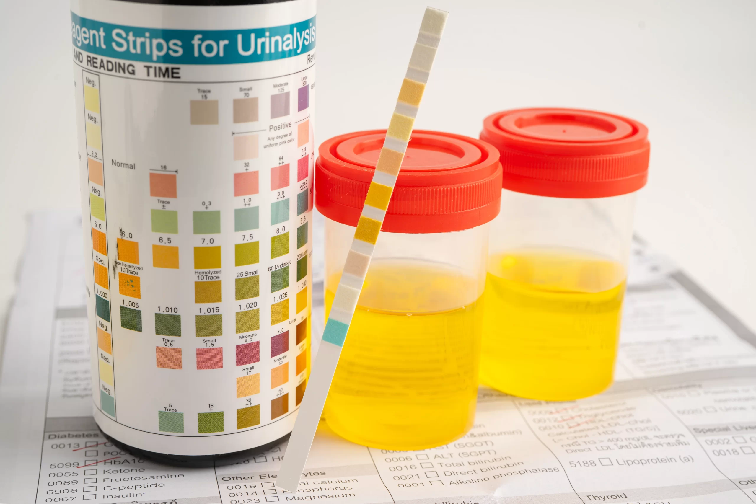 Read more about the article Understanding the Urine Test Portion of a DOT Physical in Charlotte, NC