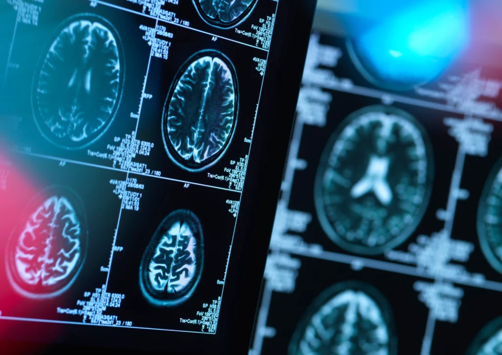 Stroke criteria for DOT physicals in Charlotte NC