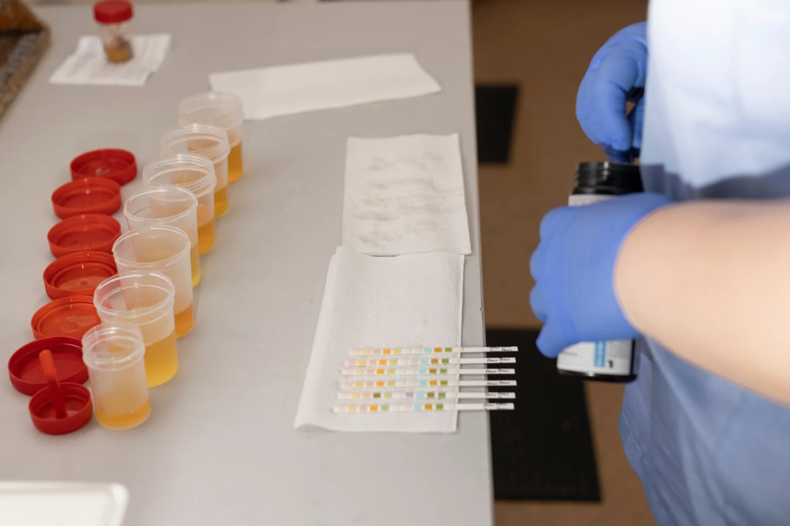 Alcohol urine testing in Charlotte nc
